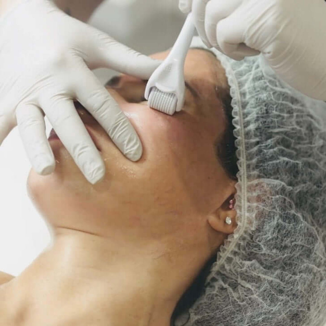 Microneedling Course