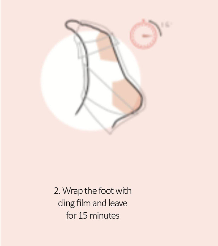 Yumi Foot Callus Removal Kit - 30 Treatments| foot callus treatment